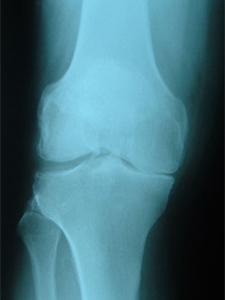 Green tea may lead to stronger bone structure
